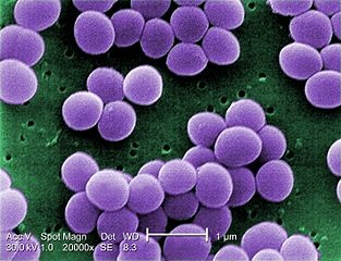 Carriage aureus (sztafilokokkusz kocsi) fuvarozása staphylococcus