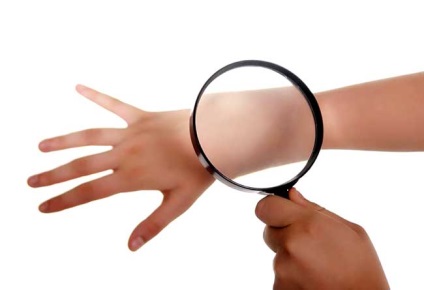 A psoriasis fellángolása, mit kell tenni, hogyan lehet gyorsan és hatékonyan elősegíti a visszaesés (csinálni) A psoriasis fellángolása, mit kell tenni, hogyan lehet gyorsan és hatékonyan elősegíti a visszaesés