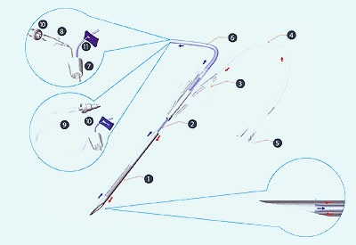Óóó - medpostavka-1 (szerepét betöltő az üzemeltető) Ó - medpostavka-1