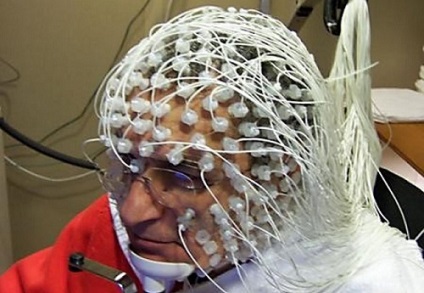 Epilepsziás tünetek, okok, diagnózis (oka) Epilepsziás tünetek, okok, diagnózis