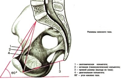 Pelviometriya - szülészet és nőgyógyászat (lehet értékelni klinikailag) Pelviometriya - Szülészeti és Nőgyógyászati