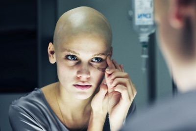Kemoterápia után, a haj kihullik - mi a teendő