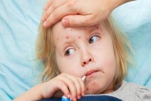 Akne és a hőmérséklet az oka a gyermek, a diagnózis (oka) Akne és a hőmérséklet egy gyerek okozza a diagnosztika