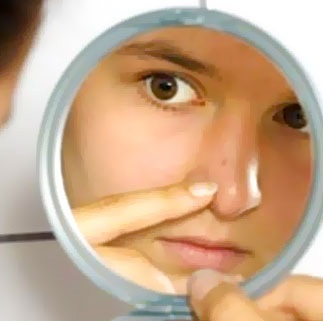 Pattanások az arcon értéke a kapcsolat a kiütés és a belső szervek