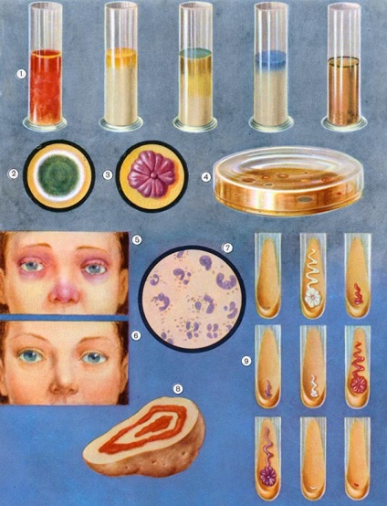 Kórokozó mikrobák - Gyermek Encyclopedia (első kiadás)