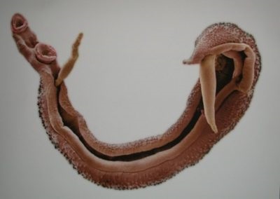 a bőr parazitái és megnyilvánulásai hogyan kell kezelni a pinworms et