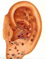 Betegségek diagnosztizálása kagylók, cikkek, Healing (pénzügyi) Betegségek diagnosztizálása kagylók, cikkek, Healing