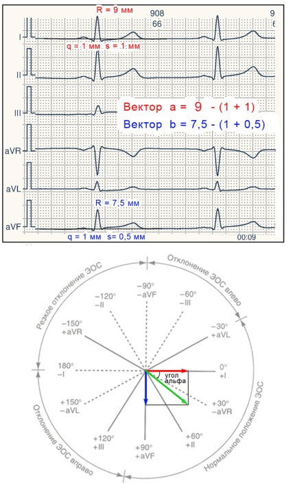 E-cardio tanulsága 7 (elektromos tengely)