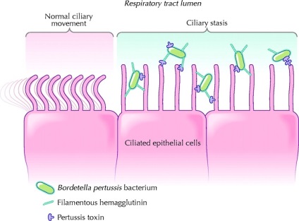 Pertussis - kórokozó (Bordetella pertussis), a betegség epidemiológiája