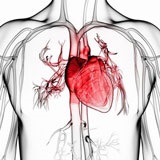 CABG miokardiális infarktus (akut szindróma) -, mi az, okok, tünetek, kezelés