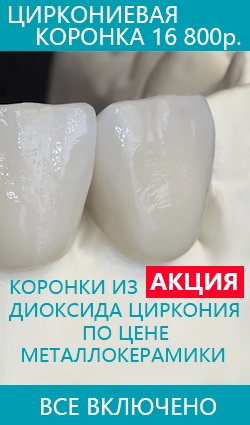 A kezelés fogászati fluorózis a gyermekek és felnőttek, a költségek (a kezelés fogászati fluorózis a gyermekek és felnőttek) A kezelés fogászati fluorózis a gyermekek és felnőttek, a költségek