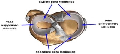 Műtét a térd meniscus műtét utáni rehabilitáció