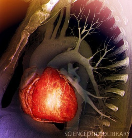 Előnyök a szív CT angiográfia és echokardiogram jelzések vizsgálata