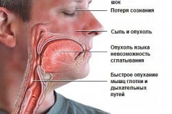 Reduxine kompatibilitás alkohol és az alkohol, a reakciót a szervezetben (alkohol) Reduxine kompatibilitás alkohol és az alkohol, a kölcsönhatás a test