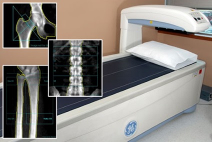 X-ray denzitometriás leolvasott, előkészítéséhez, elvégzéséhez