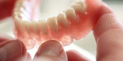 Сонник зубні протези до чого сниться зубні протези уві сні