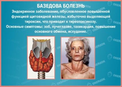 Thyreotoxikus válság (válság) thyreotoxikus válság