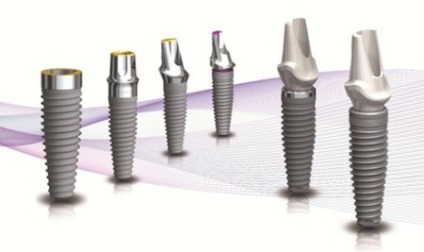 Típusú fogászati ​​implantátumok