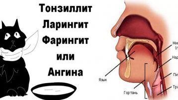Torokfájás, fájdalmas nyelés - mint kezelni otthon, a gyerek, mit kell tenni, ha az erős