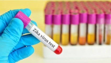 Mi Zeke (13 fotó) vírus - triniksi (láz) Mi Zeke (13 fotó) vírus - triniksi