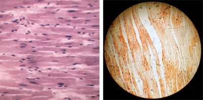 Diftéria kórokozó, járványtan és patogenezise (Corynebacterium diphtheriae Gravis) A diftéria kórokozó, járványtan és patogenezise