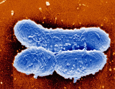 Diftéria kórokozó, járványtan és patogenezise (diftéria Bacillus átviteli út diftéria patogenezisében) A diftéria kórokozó, járványtan és patogenezise
