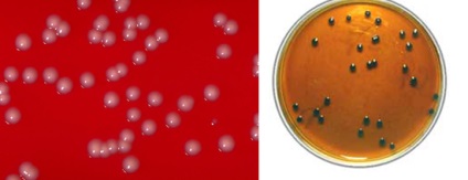 Diftéria kórokozó, járványtan és patogenezise (diftéria Bacillus átviteli út diftéria patogenezisében) A diftéria kórokozó, járványtan és patogenezise