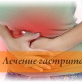 Dopstimye norma fogyasztása paradicsom gastritis (gyomorhurut) Dopstimye szabványokat használja paradicsom gyomorhurut