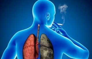 Tüdőtágulás - élet prognózis, gyógyszerek és kezelés