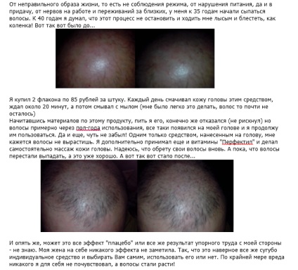 Esvitsin haj véleménye, használati utasítások, összetétel és az ár (esvitsin) Esvitsin haj véleménye, használati utasítások, összetétele és ára
