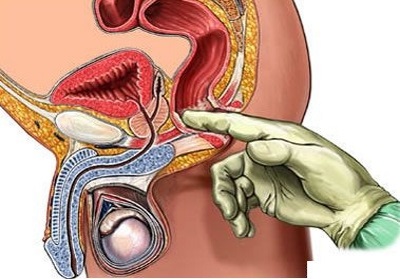 Fizioterápia prostatitis alkalmazása lökéshullám, mágneses terápia, az applikátor