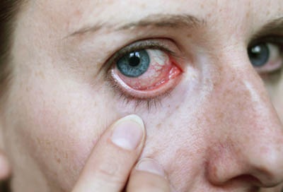 Szemcseppek lekrolin - mentett a szem allergiás megbetegedéseinek (csepp) Szemcsepp lekrolin - mentett allergiás szembetegségek