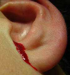 Hogyan lehet megállítani a vérzést a fülből