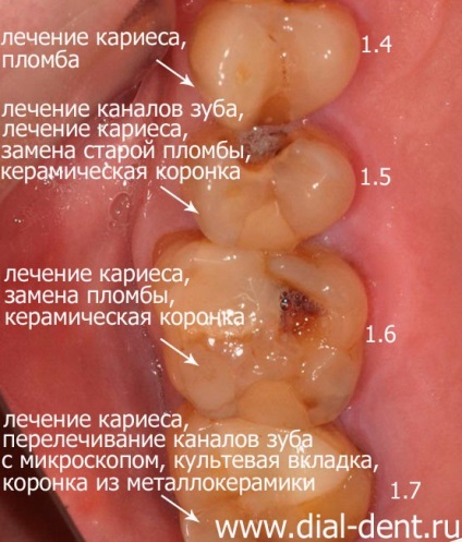 integrált fogászat