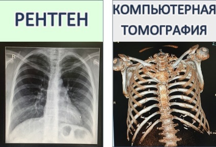 Komputertomográfia kérdések és válaszok (számítógép) Komputertomográfiát kérdések és válaszok