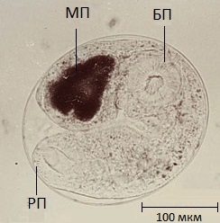 Cat métely (trematoda) a szerkezet, elosztó, a tünetek és a kezelés (métely) Cat métely (trematoda) a szerkezet, forgalmazás, tünetek és a kezelés