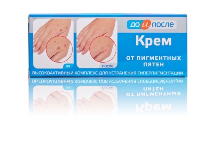 Cream „előtte és utána” pigment foltok készítmény, akció, jelzések