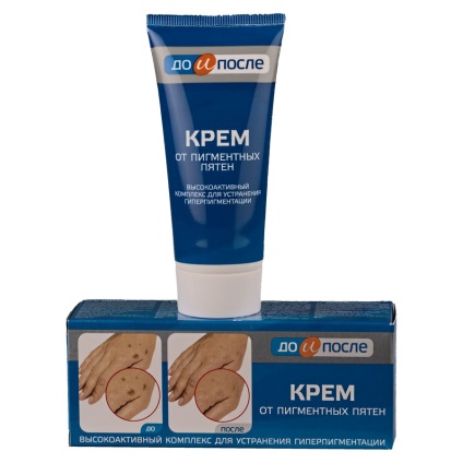 Krémek pigment foltok előtt és után a használati utasítást, ár, áttekintésre, leírások (foltok) Krémek pigment foltok előtt és után a használati utasítást, ár, vélemények, leírások