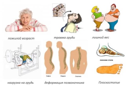 mell spondylarthrosis népi jogorvoslati kezelés () mellkasi spondiloarthritisz kezelése népi jogorvoslat