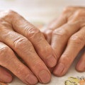 A kezelés spondiloarthritisz népi jogorvoslati otthon