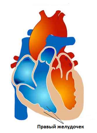 Pulmonális szív betegség tünetei - kezelés a szív