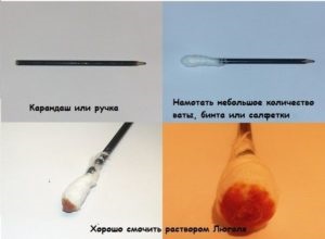 Angina Lugol oldat és porlasztva segít, ha (segít) Angina Lugol oldat és spray-segít-e