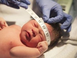Fej kerülete az újszülött, ezért rendszeres ellenőrzés fontos