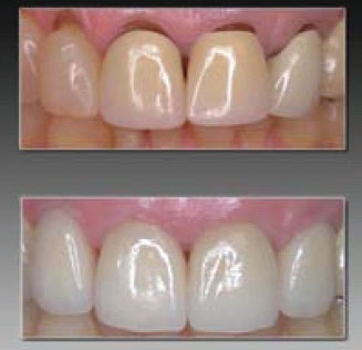 A periodontitis etiopatogenezisében, klinikai kép, a kezelés