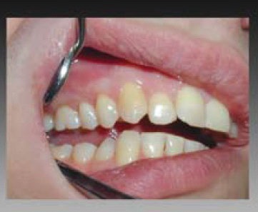 A periodontitis etiopatogenezisében, klinikai kép, a kezelés