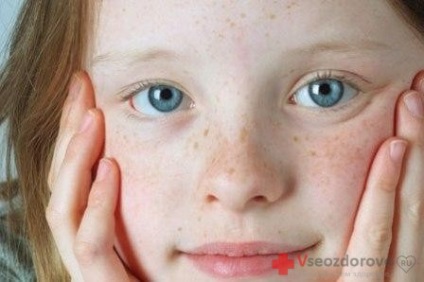 Bőr pigmentációs - szól az egészségügyi