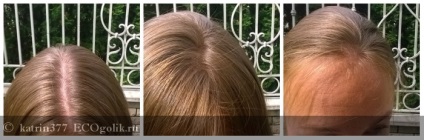 Herbal maszk haj és a fejbőr hajhullás ellen és a haj növekedésének gyorsítását kleona -