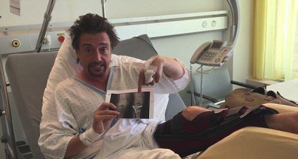 Richard Hammond majdnem meghalt egy autóbalesetben