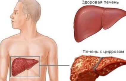 Hány alkoholisták élnek várható és az életminőség