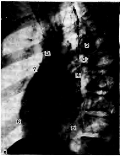 Topográfiája Heart - klinikai anatómiája a szív